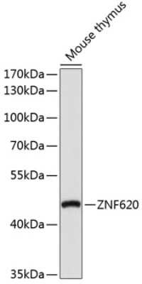 Western Blot: ZNF620 AntibodyAzide and BSA Free [NBP2-94038]